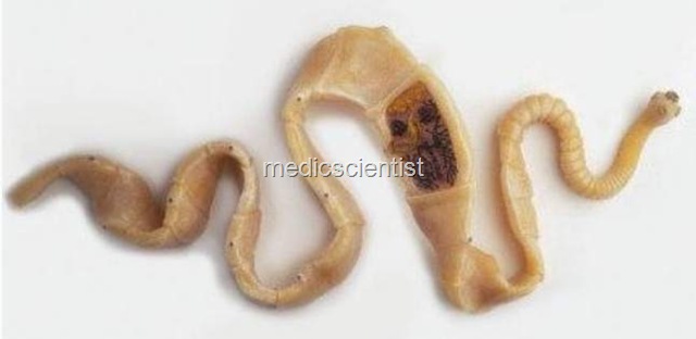 [TAENIA SOLIUM j[2].jpg]