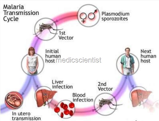 [Liver dysfunction in malaria Hemolytic jaundice[2].jpg]