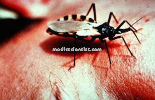 [protozoan Trypanosoma 2[2].jpg]