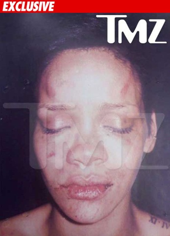 [Popstar rihanna photo after beaten by Chris Brown TMZ[3].jpg]