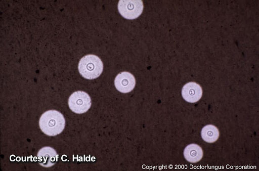 how does va rate multiple myeloma