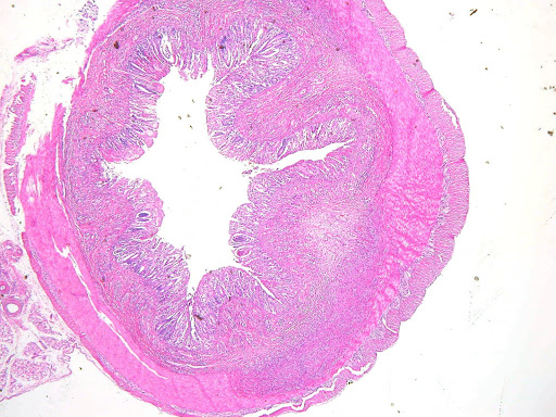 how does drinking alcohol affect clostridium difficile