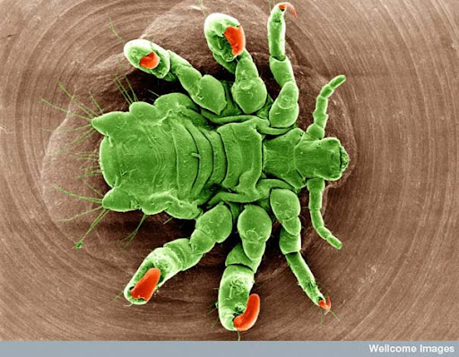 Looking-at-the-World-through-a-Microscope-PII-pubic-louse1.jpg