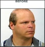 john-before