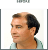 restoration_lloyd-before