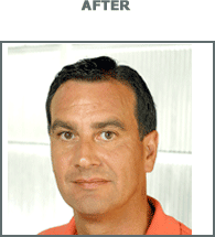 [restoration_lloyd-after[20].png]