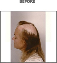 [woman2-before[14].jpg]