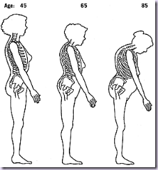 Shrinking_Woman
