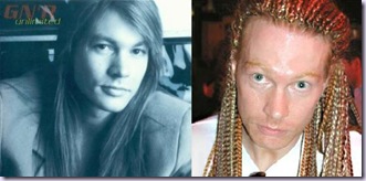 axl-rose-plastic-surgery
