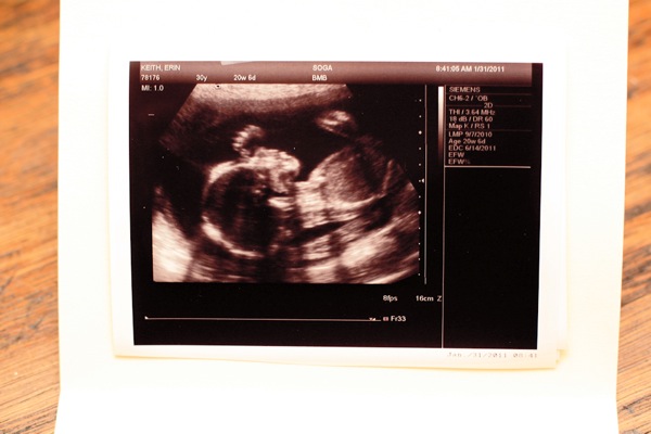 Baby 1