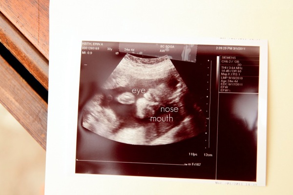 Baby 1named