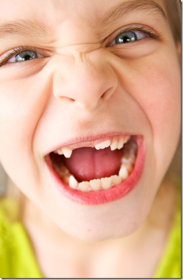 Morgans front tooth-9298