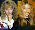Kylie Minogue in 1987. and today. - Smells like plastic surgery to me.
