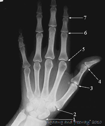 [wrist_hand_x_ray[2].gif]