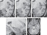 amygdala-brain-scans amygdala-brain-scans
