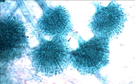 [Aspergillis[2].jpg]