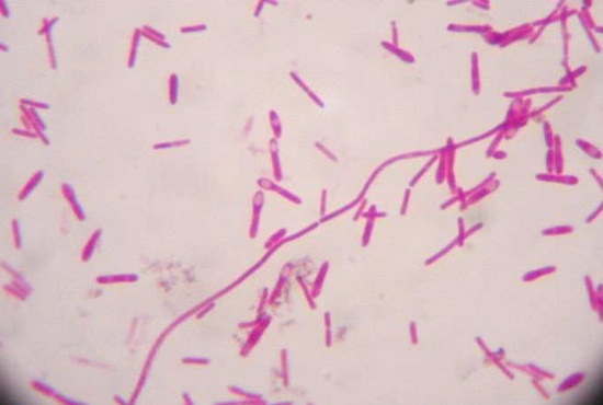 [Clostridium Botulinum[2].jpg]