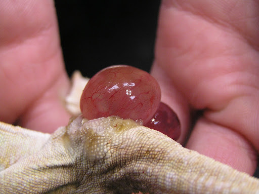 prolapse women and big stomach