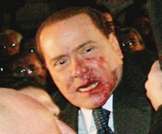 Berlusconi colpito nell' aggressione a Milano con il Duomo versione souvenir