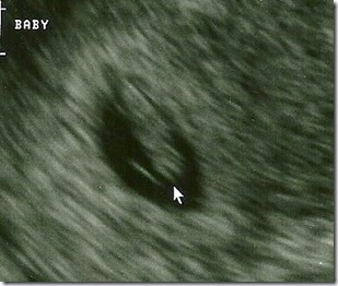 Ultrasound Baby 3 7 weeks
