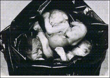 ABORTO 3