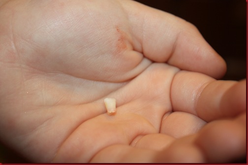 Hannah's first lost tooth!