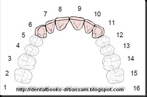 Partial Denture Design Template - FREE DOWNLOAD