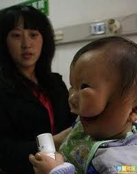 [imagesChinese baby born with mask face 2[3].jpg]