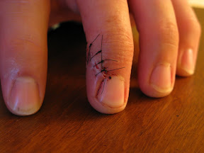 Day Two.  Bandage freshly removed, and it's time to let it breath.  You can see from this view that the slice butts right up against my fingernail.  Without that nail, I'm afraid I would have lost a lot more than just a little blood.