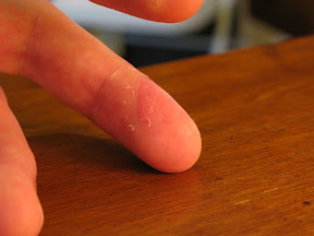 Day 16.  Looking pretty good... even the stitch holes are fading.