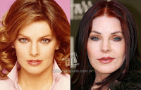 priscilla presley before surgery