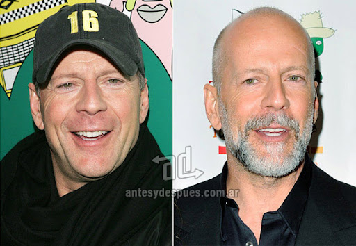 bruce willis beard - before and after
