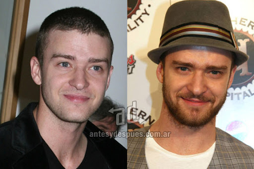 justin timberlake beard - before and after