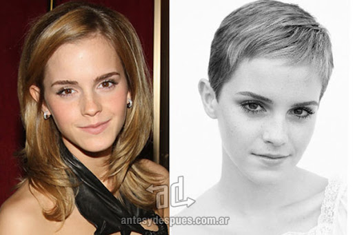Emma Watson con el pelo corto y con pelo largo foto del antes y despues