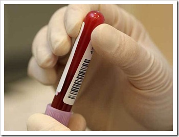 size_590_exame-sangue size_590_exame-sangue