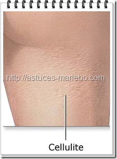 cellulite cellulite