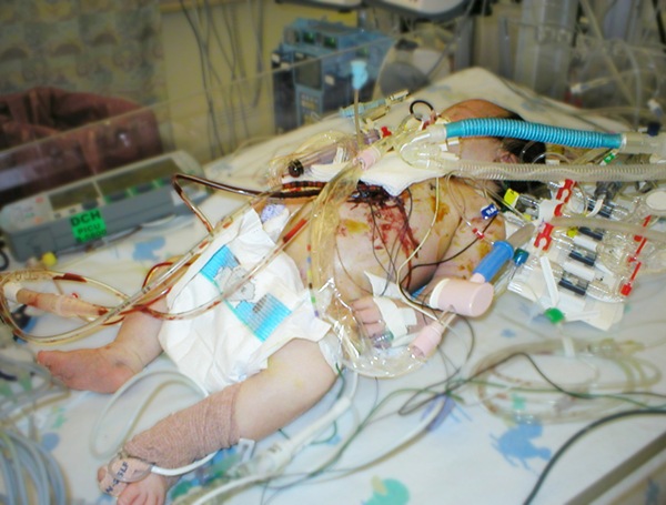 print_emma_aftersurgery1