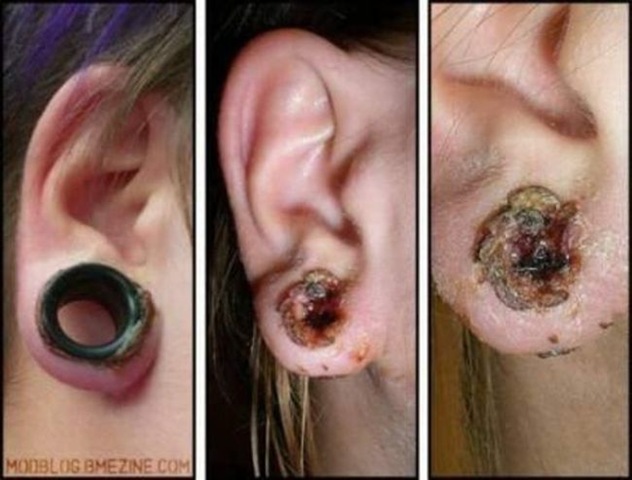 [Piercings&alargadores (8)[3].jpg]