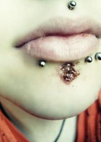 [Piercings&alargadores (11)[3].jpg]