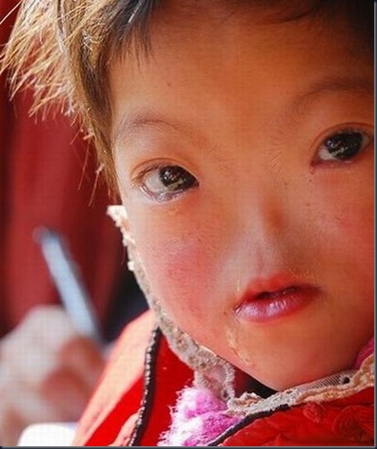 victims_of_pollution_in_china_07 victims_of_pollution_in_china_07