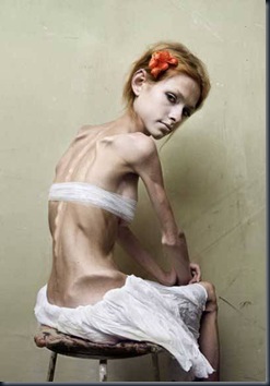 012anorexia