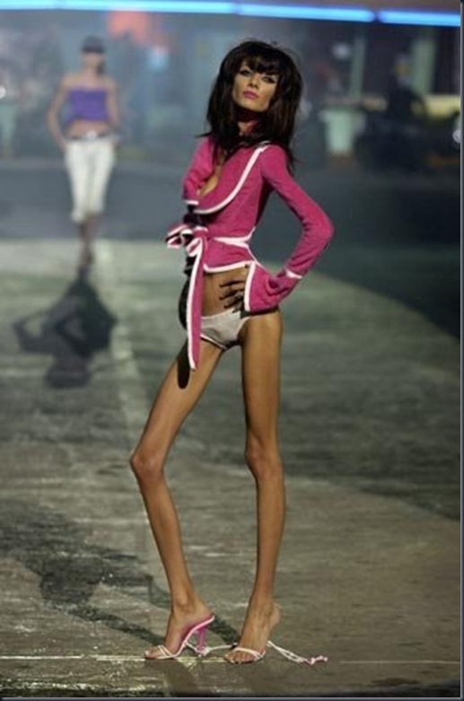 Anorexia12 Anorexia12