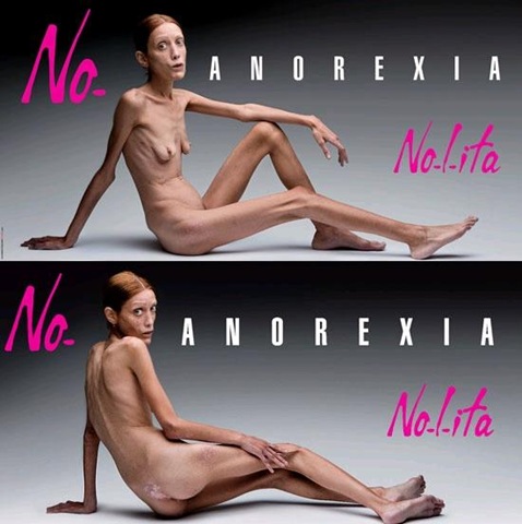 [anorexia-campanha[4].jpg]