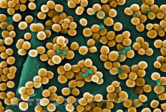 [staphylococcus_aureus_electron_microscope[2].jpg]