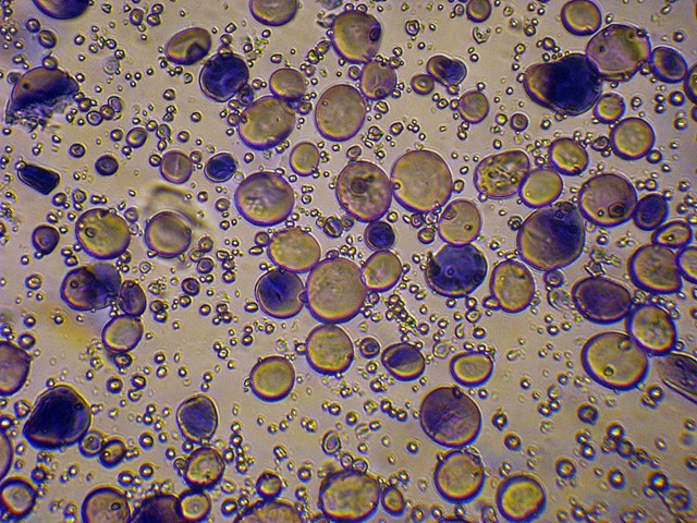 [800px-Wheat_starch_granules[7].jpg]
