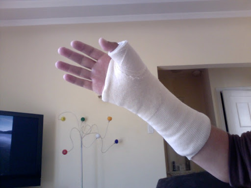 my wrist cast