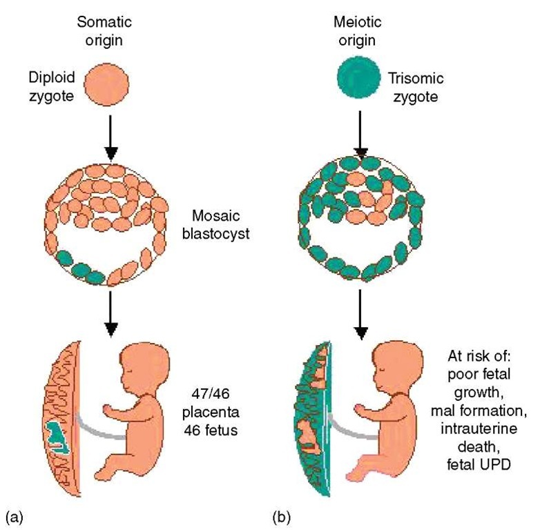 Origin of trisomy mosaicism may be somatic (a) or meiotic (b) 