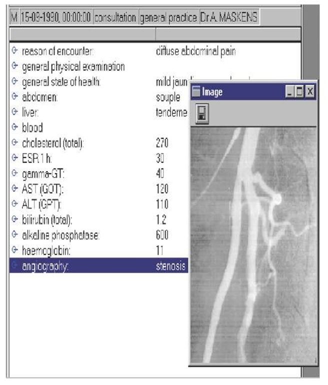 Digital angiography 