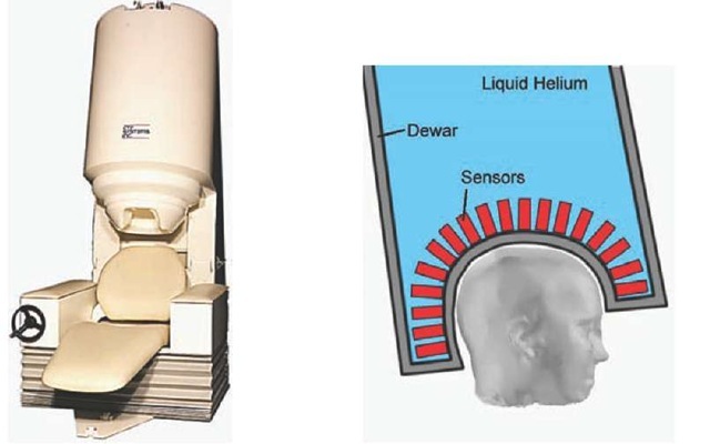 Whole-head CTF Omega MEG system with 275 axial gradiometers (left), and MEG sensors using low-temperature electronics cooled by liquid helium (right) 