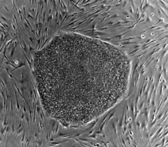The photo shows a human embryonic stem cell colony on a mouse embryonic fibroblast feeder layer. 